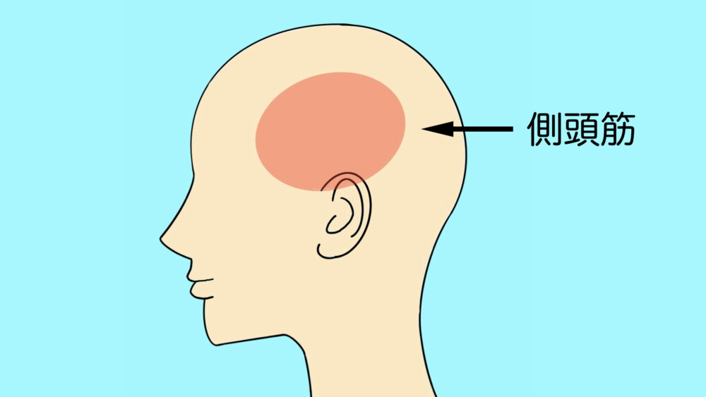 側頭筋の図